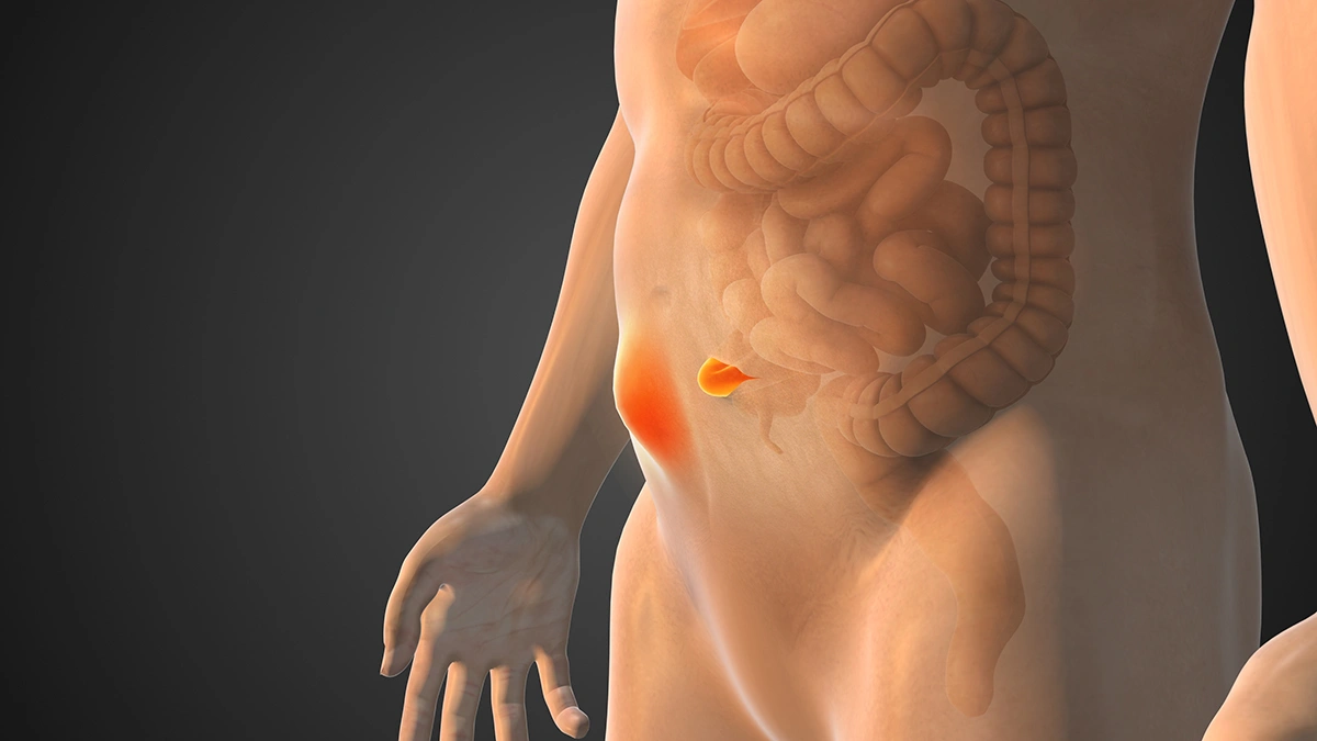 What Are the Different Types of Hernias